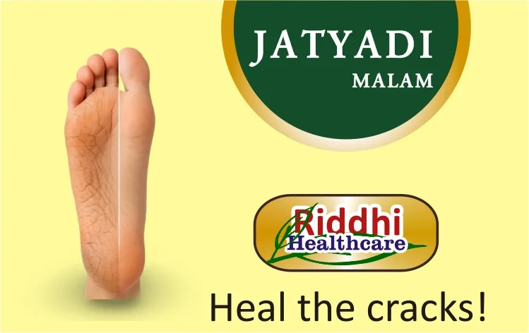 Before and after results of Jatyadi Malam for cracked heels by Riddhi Healthcare.